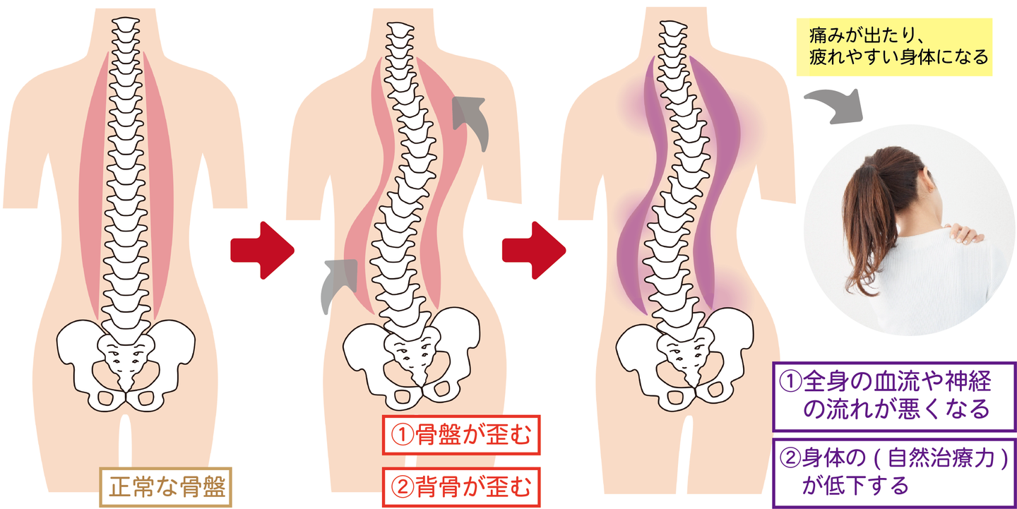 産後骨盤矯正で不調改善